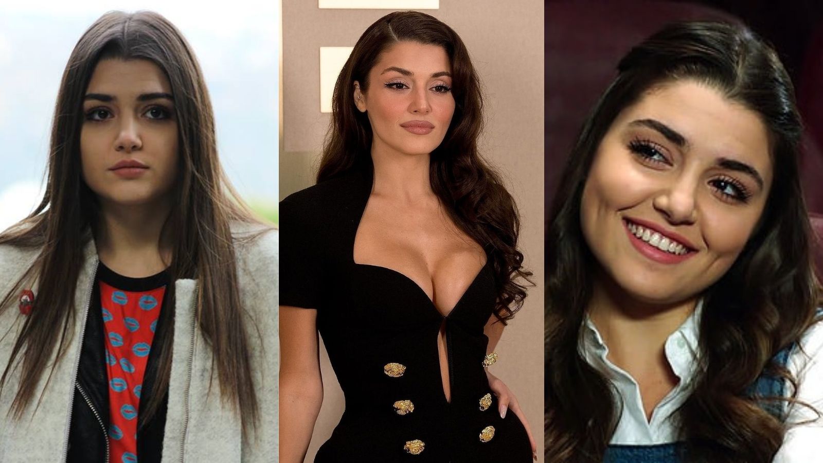 Hande Erçel estetikleri - Magazin Haberleri