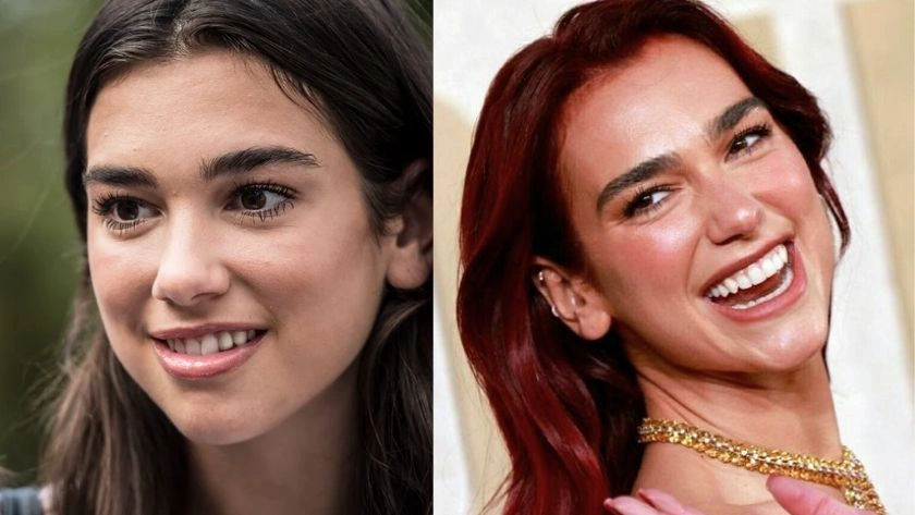 Ünlüler Dişlerine Ne Yaptırıyor? Öncesi ve Sonrası - Magazin Haberleri
